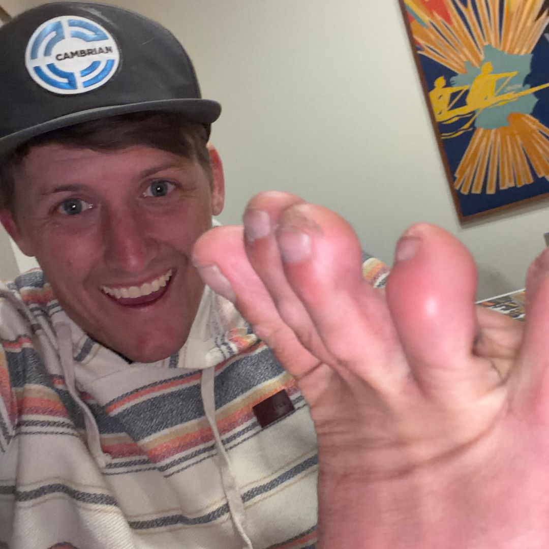 A glorious foot